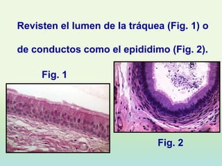Revisten el lumen de la tráquea (Fig. 1) o

de conductos como el epididimo (Fig. 2).

     Fig. 1




                              Fig. 2
 