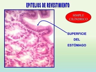 SIMPLE
 CILÍNDRICO



SUPERFICIE
   DEL
ESTÓMAGO
 