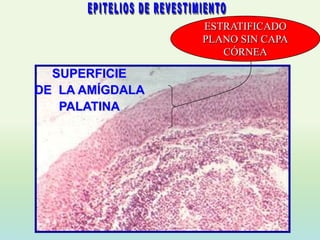 ESTRATIFICADO
                     PLANO SIN CAPA
                        CÓRNEA

  SUPERFICIE
DE LA AMÍGDALA
   PALATINA

                 2
 