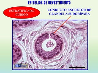 ESTRATIFICADO   CONDUCTO EXCRETOR DE
   CÚBICO        GLÁNDULA SUDORÍPARA
 