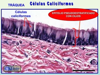 TRÁQUEA

   Células      EPITELIO PSEUDOESTRATIFICADO
 caliciformes             CON CILIOS
 
