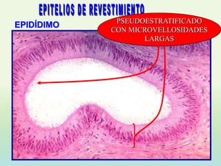 PSEUDOESTRATIFICADO
EPIDÍDIMO
            CON MICROVELLOSIDADES
                   LARGAS
 