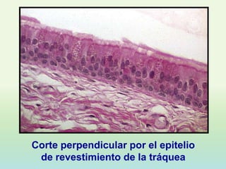 Corte perpendicular por el epitelio
 de revestimiento de la tráquea
 