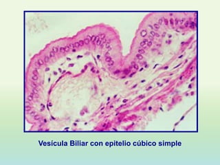 Vesícula Biliar con epitelio cúbico simple
 