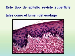 Este tipo de epitelio reviste superficie

tales como el lumen del esófago
 