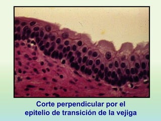Corte perpendicular por el
epitelio de transición de la vejiga
 