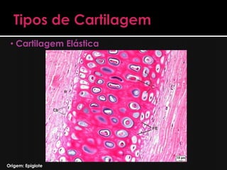 • Cartilagem Elástica




Origem: Epiglote
 