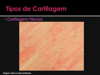 • Cartilagem Fibrosa




Origem: Discos Intervertebrais
 