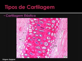 • Cartilagem Fibrosa




Origem: Discos Intervertebrais
 