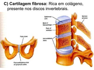 C) Cartilagem fibrosa: Rica em colágeno,
 presente nos discos invertebrais.
 