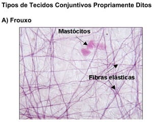 Tipos de Tecidos Conjuntivos Propriamente Ditos

A) Frouxo
 