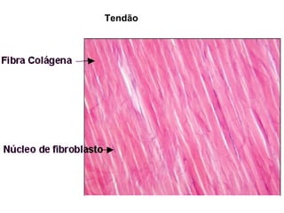 Tendão
 