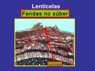 Lenticelas
Fendas no súber




        Lenticela
 