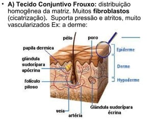 • A) Tecido Conjuntivo Frouxo: distribuição
homogênea da matriz. Muitos fibroblastos
(cicatrização). Suporta pressão e atritos, muito
vascularizados Ex: a derme:

 