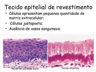 Tecido epitelial de revestimento
• Células apresentam pequenas quantidade de
matriz extracelular;
• Células justaposta;
• Ausência de vasos sanguineos;

Tecido da cavidade bucal

Tecido intestino

 