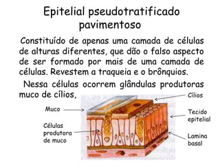 Epitelial pseudotratificado
pavimentoso
Constituído de apenas uma camada de células
de alturas diferentes, que dão o falso aspecto
de ser formado por mais de uma camada de
células. Revestem a traqueia e o brônquios.
Nessa células ocorrem glândulas produtoras
muco de cílios,
Cílios
Muco
Células
produtora
de muco

Tecido
epitelial
Lamina
basal

 