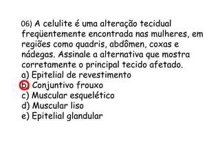 06) A celulite é uma alteração tecidual
freqüentemente encontrada nas mulheres, em
regiões como quadris, abdômen, coxas e
nádegas. Assinale a alternativa que mostra
corretamente o principal tecido afetado.
a) Epitelial de revestimento
b) Conjuntivo frouxo
c) Muscular esquelético
d) Muscular liso
e) Epitelial glandular

 