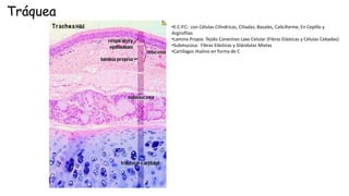Tráquea
•E.C.P.C: con Células Cilíndricas, Ciliadas, Basales, Caliciforme, En Cepillo y
Argirofilas
•Lamina Propia: Tejido Conectivo Laxo Celular (Fibras Elásticas y Células Cebadas)
•Submucosa: Fibras Elásticas y Glándulas Mixtas
•Cartílagos Hialino en forma de C
 