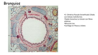 Bronquios
•E. Cilíndrico Pseudo Estratificado Ciliado
con Células Caliciformes
•Tejido Conectivo Lx Celular con fibras
elásticas
•Musculo Liso
•Cartílago en Placas o Islotes
 
