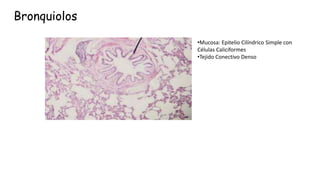 Bronquiolos
•Mucosa: Epitelio Cilíndrico Simple con
Células Caliciformes
•Tejido Conectivo Denso
 