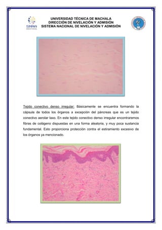 UNIVERSIDAD TÉCNICA DE MACHALA
DIRECCIÓN DE NIVELACIÓN Y ADMISIÓN
SISTEMA NACIONAL DE NIVELACIÓN Y ADMISIÓN

Tejido conectivo denso irregular: Básicamente se encuentra formando la
cápsula de todos los órganos a excepción del páncreas que es un tejido
conectivo aerolar laxo. En este tejido conectivo denso irregular encontraremos
fibras de colágeno dispuestas en una forma aleatoria, y muy poca sustancia
fundamental. Esto proporciona protección contra el estiramiento excesivo de
los órganos ya mencionado.

 