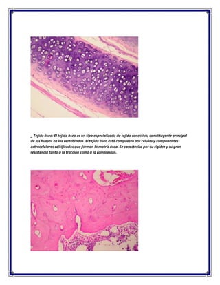 _ Tejido óseo: El tejido óseo es un tipo especializado de tejido conectivo, constituyente principal
de los huesos en los vertebrados. El tejido óseo está compuesto por células y componentes
extracelulares calcificados que forman la matriz ósea. Se caracteriza por su rigidez y su gran
resistencia tanto a la tracción como a la compresión.

 