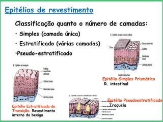 Epitélios de revestimento
Classificação quanto o número de camadas:
• Simples (camada única)
• Estratificado (várias camadas)
•Pseudo-estratificado
Epitélio Simples Prismático
R. intestinal
Epitélio Estratificado de
Transição: Revestimento
interno da bexiga
Epitélio Pseudoestratificado
Traqueia
 