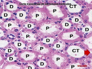 Histologia Del Riñon | PPT