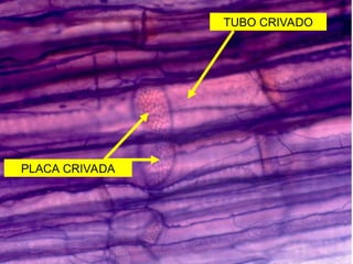 TUBO CRIVADO
PLACA CRIVADA
 
