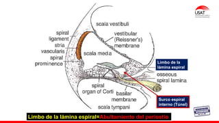 Limbo de la
lámina espiral
Limbo de la lámina espiral=Abultamiento del periostio
Surco espiral
interno (Túnel)
 