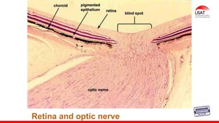 M. Tesen
Retina and optic nerve
 
