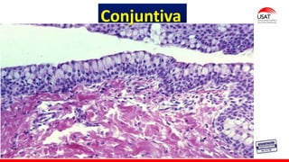 M. Tesen
Conjuntiva
 