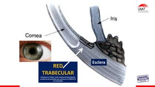 M. Tesen
RED
TRABECULAR
Ubicado en el limbo: unión esclerocorneal (espacios
recubiertos de endotelio que conducen al CONDUCTO
DE SCHLEMM)
Esclera
 