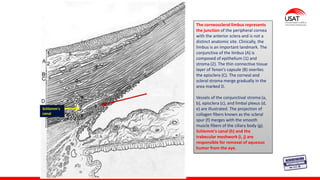 M. Tesen
The corneoscleral limbus represents
the junction of the peripheral cornea
with the anterior sclera and is not a
distinct anatomic site. Clinically, the
limbus is an important landmark. The
conjunctiva of the limbus (A) is
composed of epithelium (1) and
stroma (2). The thin connective tissue
layer of Tenon's capsule (B) overlies
the episclera (C). The corneal and
scleral stroma merge gradually in the
area marked D.
Vessels of the conjunctival stroma (a,
b), episclera (c), and limbal plexus (d,
e) are illustrated. The projection of
collagen fibers known as the scleral
spur (f) merges with the smooth
muscle fibers of the ciliary body (g).
Schlemm's canal (h) and the
trabecular meshwork (i, j) are
responsible for removal of aqueous
humor from the eye.
Schlemm's
canal
RED
TRABECULAR
 