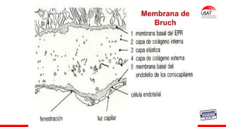 M. Tesen
Membrana de
Bruch
 