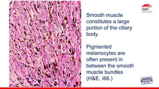 M. Tesen
Smooth muscle
constitutes a large
portion of the ciliary
body.
Pigmented
melanocytes are
often present in
between the smooth
muscle bundles
(H&E, í66.)
 
