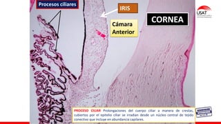 M. Tesen
IRIS
CORNEA
Cámara
Anterior
Procesos ciliares
PROCESO CILIAR Prolongaciones del cuerpo ciliar a manera de crestas,
cubiertos por el epitelio ciliar se irradian desde un núcleo central de tejido
conectivo que incluye en abundancia capilares.
 