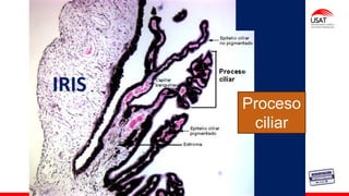 M. Tesen
IRIS
Proceso
ciliar
 