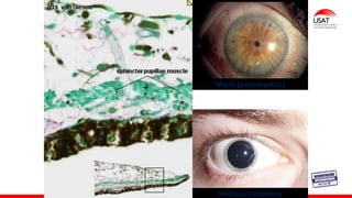 M. Tesen
Miosis (parasimpatico)
Midriasis (simpático)
 