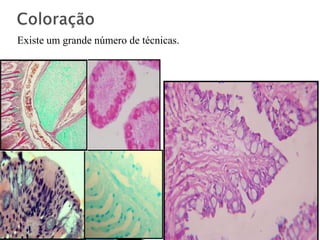 Existe um grande número de técnicas.
 