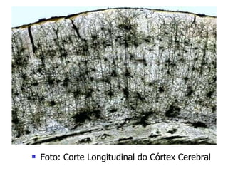 Foto: Corte Longitudinal do Córtex Cerebral 
