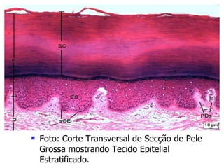 Foto: Corte Transversal de Secção de Pele Grossa mostrando Tecido Epitelial Estratificado.  