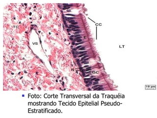 Foto: Corte Transversal da Traquéia mostrando Tecido Epitelial Pseudo-Estratificado. 