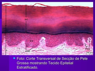    Foto: Corte Transversal de Secção de Pele
    Grossa mostrando Tecido Epitelial
    Estratificado.
 