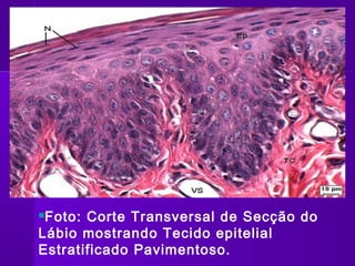 Foto: Corte Transversal de Secção do
Lábio mostrando Tecido epitelial
Estratificado Pavimentoso.
 