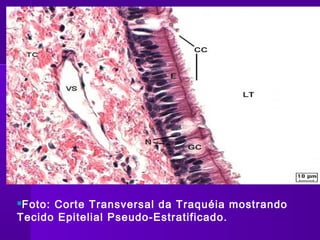 Foto: Corte Transversal da Traquéia mostrando
Tecido Epitelial Pseudo-Estratificado.
 