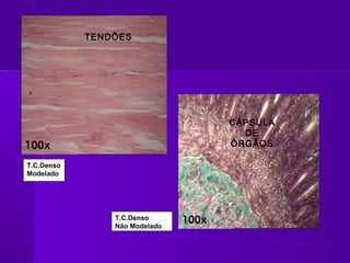 TENDÕES




                               CÁPSULA
                                 DE
                               ÓRGÃOS

T.C.Denso
Modelado




                T.C.Denso
                Não Modelado
 