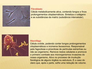 Fibroblasto
Célula metabolicamente ativa, contendo longos e finos
prolongamentos citoplasmáticos. Sintetiza o colágeno
e as substâncias da matriz (substância intercelular).
Macrófago
Célula ovóide, podendo conter longos prolongamentos
citoplasmáticos e inúmeros lisossomos. Responsável
pela fagocitose e pinocitose de pertículas estranhas ou
não ao organismo. Remove restos celulares e promove
o primeiro combate aos microrganismos invasores do
nosso organismo. Ativo no processo de involução
fisiológica de alguns órgãos ou estrutura. É o caso do
útero que, após o parto, sofre uma redução de volume.
 