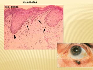 melanócitos
 