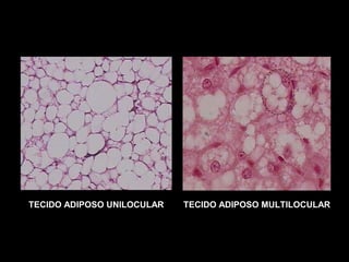TECIDO ADIPOSO UNILOCULAR TECIDO ADIPOSO MULTILOCULAR
 
